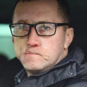 A catastrophic crash shattered his life, leaving him with injuries that would change everything.