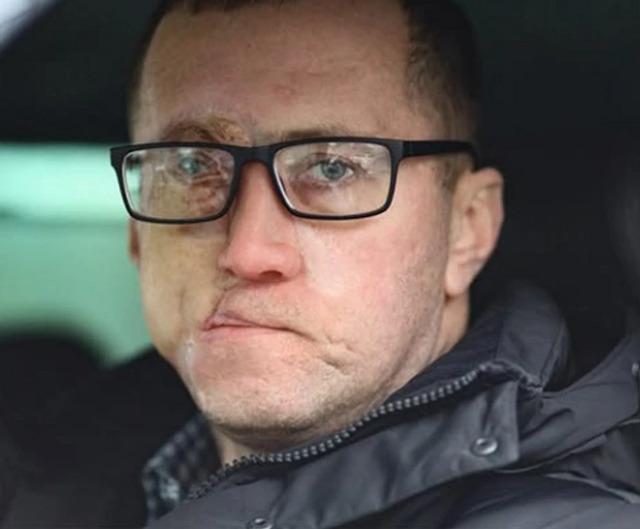 A catastrophic crash shattered his life, leaving him with injuries that would change everything.