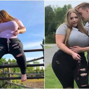 Shocking Love, No Filters: Matt and Brittany’s Journey Beyond Society’s Beauty Standards